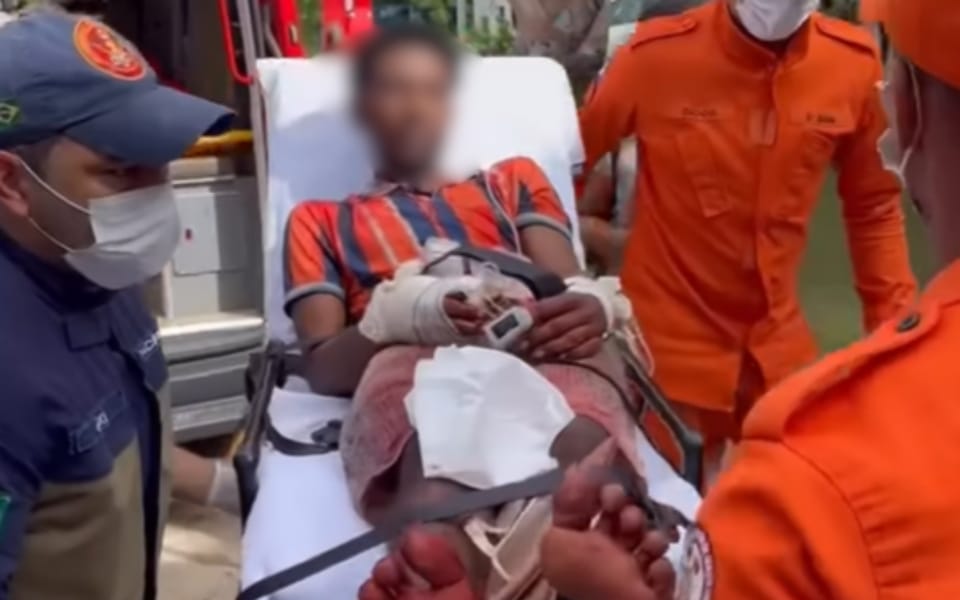 Homem é atingido com golpe de facão por vizinho e quase perde a mão durante discussão