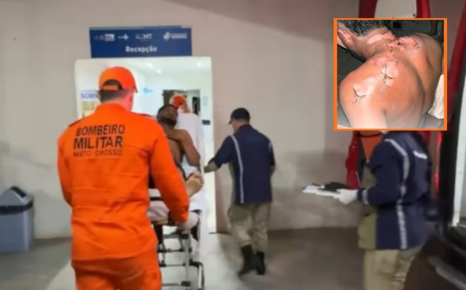 Mulher que ateou fogo no companheiro é presa e alega ter sido agredida