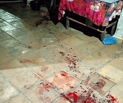 Mulher esfaqueia marido após ser agredida durante discussão em MT