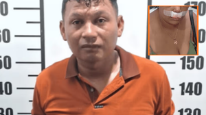 Homem é preso suspeito de agredir e arrancar lábio da esposa com uma faca