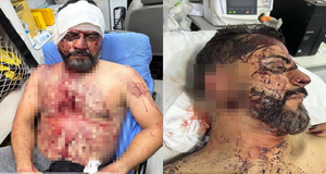 Ensanguentado e com orelha cortada: imagens mostram vereador no hospital após assalto