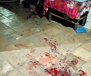 Mulher esfaqueia marido após ser agredida durante discussão em MT